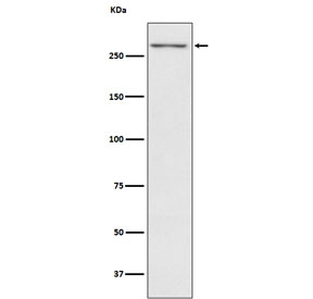 Western blot testing with TG antibody. Predicted molecular weight ~305 kDa.