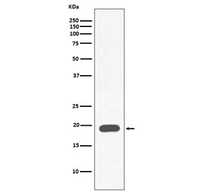 Western blot testing of human heart lysate with Myoglobin antibody. Predicted molecular weight ~17 kDa.
