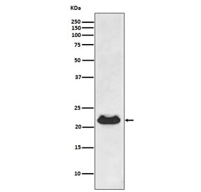 Western blot testing of human fetal heart lysate with Alpha B Crystallin antibody. Predicted molecular weight ~20 kDa.