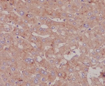 IHC staining of FFPE human liver tissue with Serum Albumin antibody. HIER: boil tissue sections in pH8 EDTA for 20 min and allow to cool before testing.