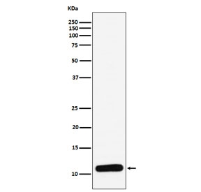 Western blot testing of human spleen lysate with PF4 antibody. Expected molecular weight: ~8/16/32 kDa (monomer/dimer/tetramer).