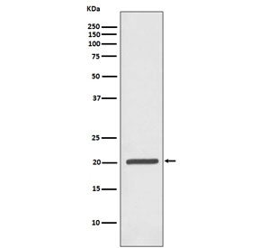 Western blot testing of human Jurkat antibody with Ferritin antibody. Predicted molecular weight ~21 kDa.