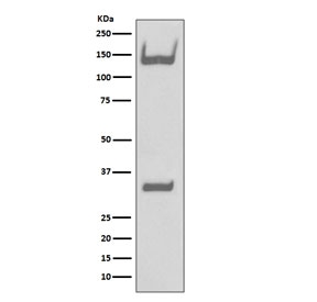 Western blot testing of human fetal brain lysate with TrkA/B/C antibody. Expected molecular weight: 85~140 kDa depending on glycosylation level.