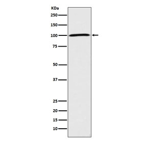 Western blot testing of human HeLa cell lysate with ATP1A1 antibody. Predicted molecular weight ~113 kDa.