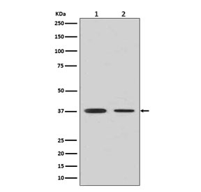 Western blot testing of human 1) fetal liver and 2) fetal lung lysate with Arginase 1 antibody. Predicted molecular weight ~35 kDa.
