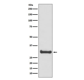 Western blot testing of human fetal brain lysate with Calbindin antibody. Predicted molecular weight: 27-28 kDa.
