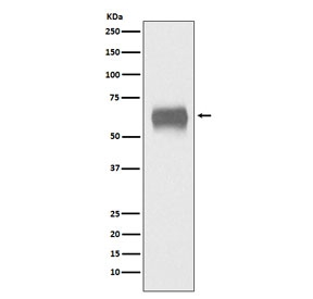 Western blot testing of human plasma lysate with CD5 antibody. Observed molecular weight: 55~67 kDa depending on glycosylation level.