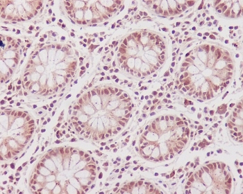 IHC staining of FFPE human colon tissue with CDK1 antibody. HIER: boil tissue sections in pH6, 10mM citrate buffer, for 10-20 min and allow to cool before testing.