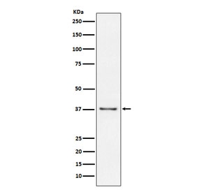 Western blot testing of human Raji cell lysate with CD23 antibody. Expected molecular weight: 37-45 kDa.