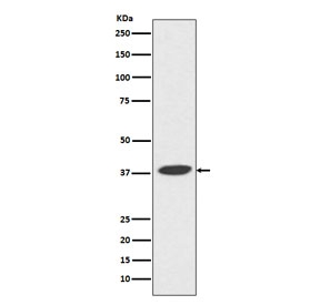 Western blot testing with POLB antibody. Predicted molecular weight ~38 kDa.