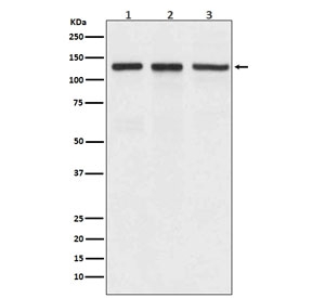 Western blot testing of 1) human A549, 2) mouse spleen and 3) rat brain lyaste with ITGAV antibody. Expected molecular weight: 116-150 kDa.