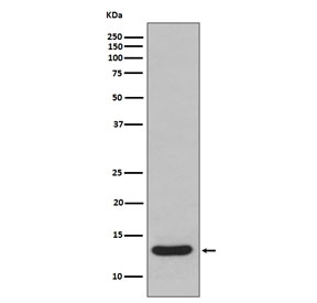 Western blot testing of human fetal liver lysate with FABP1 antibody. Predicted molecular weight ~14 kDa.