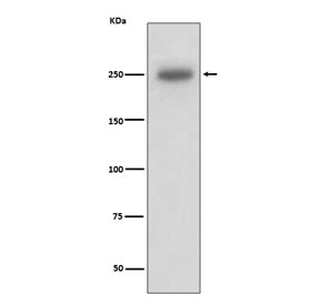 Western blot testing of human A431 cell lysate with LAMB1 antibody. Predicted molecular weight ~198 kDa, observed at 220-240 kDa.