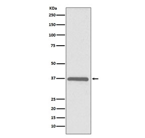 Western blot testing of human HeLa cell lysate with ERCC1 antibody. Predicted molecular weight ~36 kDa.