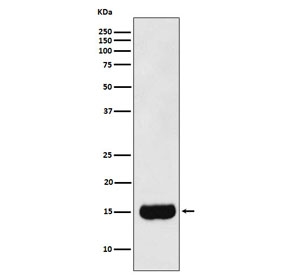Western blot testing of human prostate cancer lysate with MSMB antibody. Predicted molecular weight ~13 kDa.