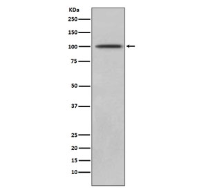 Western blot testing of human Jurkat cell lysate with Neprilysin antibody. Routinely visualized at ~100 kDa.