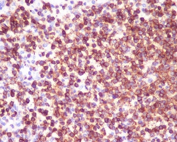IHC staining of FFPE human spleen tissue with CD45 antibody. HIER: boil tissue sections in pH6, 10mM citrate buffer, for 10-20 min and allow to cool before testing.