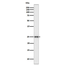 Western blot testing of human SH-SY5Y cell lysate with PGP9.5 antibody. Predicted molecular weight ~25 kDa.