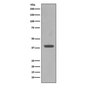 Western blot testing of E. coli lysate with Maltose Binding Protein antibody. Predicted molecular weight ~43 kDa.