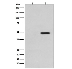 Western blot testing of 1) lysate from untreated SH-SY5Y cells and 2) lysate from sorbitol-treated SH-SY5Y cells, with phospho-Tau antibody (pT231). The expected molecular weight of phosphorylated Tau (Ser198) is approximately 45-70 kDa, corresponding to the major Tau isoforms, and lower molecular weight bands around ~35 kDa may represent truncated Tau fragments commonly observed in brain tissue.