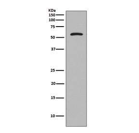 Western blot testing of human SH-SY5Y cell lysate with Tau antibody. Expected molecular weight: 50-80 kDa.