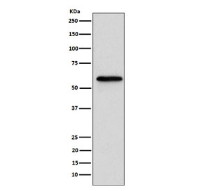 Western blot testing of human MCF7 cell lysate with RARB antibody. Predicted molecular weight ~51 kDa.