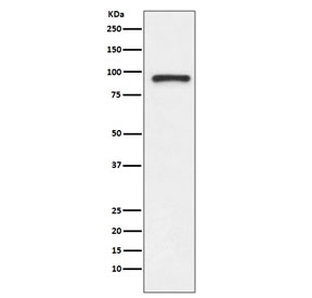 Western blot testing of human Jurkat cell lysate with TOP1 antibody. Expected molecular weight: 91-100 kDa.