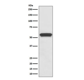 Western blot testing of rat brain lysate with Aromatase antibody. Predicted molecular weight ~58 kDa.
