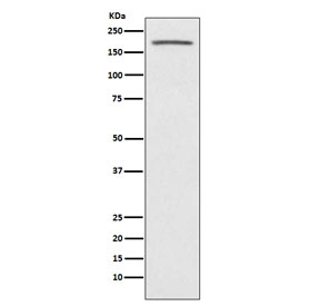 Western blot testing of human fetal kidney lysate with ACE antibody. Predicted molecular weight: 140-170 kDa.