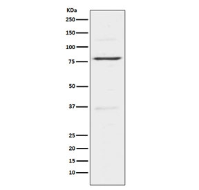 Western blot testing of human HeLa cell lysatse with INSRR antibody. Expected molecular weight: ~80 kDa, 144 kDa.