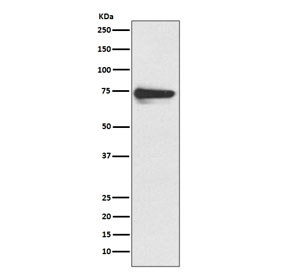 Western blot testing of human melanoma lysate with Tyrosinase antibody. Predicted molecular weight: 60-84 kDa depending on level of glycosylation.