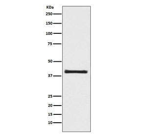Western blot testing of human 293T cell lysate with AKT1S1 antibody. Expected molecular weight ~40 kDa.