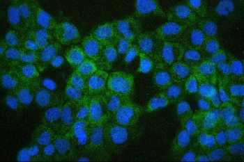Immunofluorescent staining of FFPE human A431 cells with COMT antibody (green) and DAPI (blue). HIER: boil tissue sections in pH6, 10mM citrate buffer, for 20 min and allow to cool before testing.