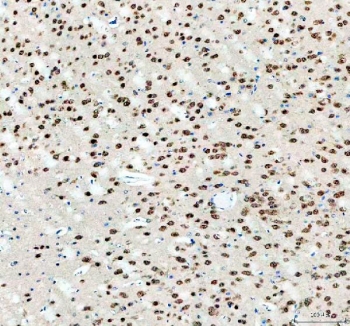 IHC staining of FFPE mouse brain tissue with Fox2 antibody. HIER: boil tissue sections in pH8 EDTA for 20 min and allow to cool before testing.