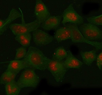Immunofluorescent staining of FFPE human HeLa cells with SIRT1 antibody (red) and Beta Tubulin mAb (green). HIER: boil tissue sections in pH6, 10mM citrate buffer, for 20 min and allow to cool before testing.