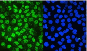 IF/ICC staining of FFPE human A431 cells with MCM2 antibody (green) at 2ug/ml and DAPI nuclear stain (blue). HIER: steam section in pH6 citrate buffer for 20 min.