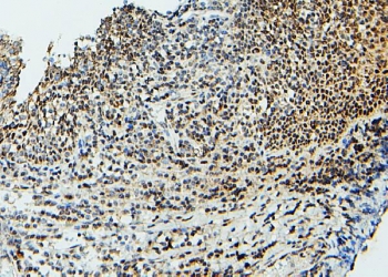 IHC staining of FFPE human tonsil with UBC9 antibody. HIER: boil tissue sections in pH6, 10mM citrate buffer, for 20 min and allow to cool before testing.