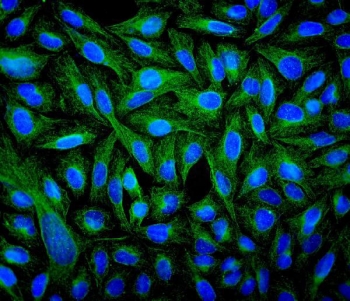 IF/ICC staining of FFPE human U-2 OS cells with Beta Tubulin antibody (green) at 2ug/ml and DAPI nuclear stain (blue). HIER: steam section in pH6 citrate buffer for 20 min.
