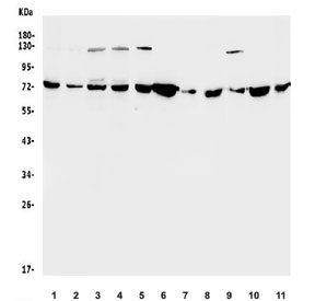 Western blot testing of human 1) HeLa, 2) HepG2, 3) HEK293, 4) Caco-2 and rat 5) brain, 6) kidney, 7) spleen, 8) liver and mouse 9) brain, 10) kidney, 11) liver lysate with SDHA antibody. Predicted molecular weight ~72 kDa.