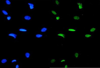 Immunofluorescent staining of FFPE human HeLa cells with GATA3 antibody (green) and DAPI nuclear stain (blue). HIER: steam section in pH6 citrate buffer for 20 min.