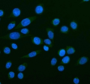 Immunofluorescent staining of FFPE human SiHa cells with NOX5 antibody (green) and DAPI nuclear stain (blue). HIER: steam section in pH6 citrate buffer for 20 min.