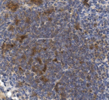 IHC staining of FFPE mouse spleen with Cd73 antibody. HIER: boil tissue sections in pH8 EDTA for 20 min and allow to cool before testing.