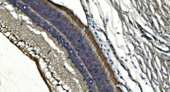 IHC staining of FFPE rat retina with PDE6 alpha antibody. HIER: boil tissue sections in pH8 EDTA for 20 min and allow to cool before testing.