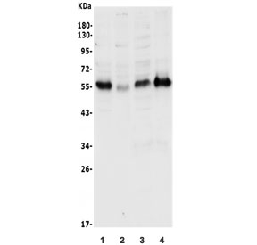 Western blot testing of human 1) Jurkat, 2) HeLa, 3) SW620 and 4) Caco-2 lysate with CDKN1C antibody. Expected molecular weight ~57 kDa.