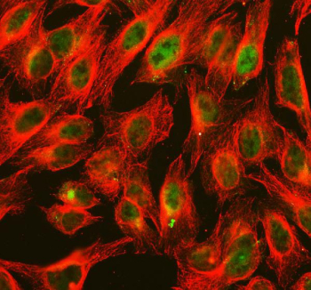 Immunofluorescent staining of FFPE human U-2 OS cells with ALKBH1 antibody (green) and Alpha Tubulin mAb (red). HIER: steam section in pH6 citrate buffer for 20 min.