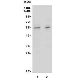 Western blot testing of mouse 1) thymus and 2) lung lysate with Ifngr2 antibody. Observed molecular weight: 37-55 kDa.