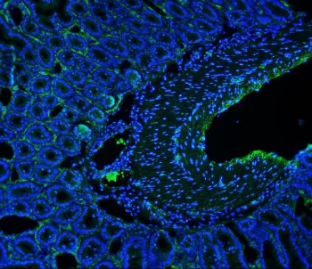 Immunofluorescent staining of FFPE mouse intestine with Cd146 antibody (green) and DAPI nuclear stain (blue). HIER: steam section in pH8 EDTA for 20 min.