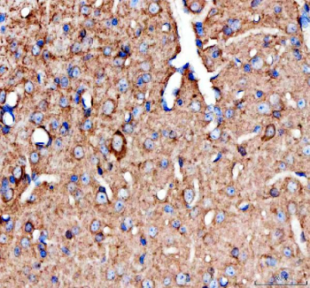 IHC staining of FFPE mouse spinal cord with Chat antibody. HIER: boil tissue sections in pH8 EDTA for 20 min and allow to cool before testing.