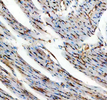 IHC staining of FFPE rat heart tissue with Cd31 antibody, HRP-secondary and DAB substrate. HIER: boil tissue sections in pH8 EDTA for 20 min and allow to cool before testing.