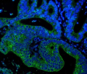Immunofluorescent staining of FFPE human placental tissue with Keratin 18 antibody (green) and DAPI nuclear stain (blue). HIER: steam section in pH8 EDTA for 20 min.